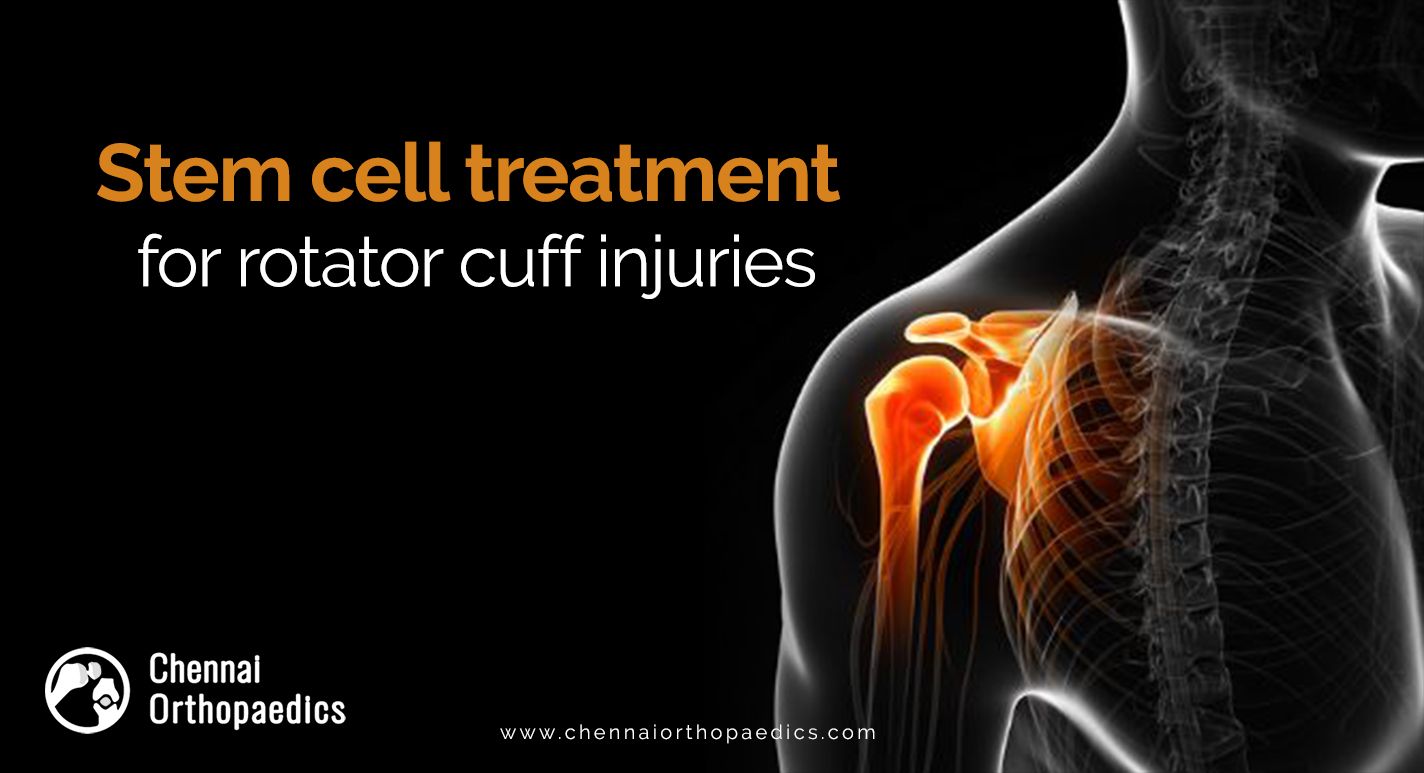 Stem Cell Treatment for Torn Rotator Cuff : Our New Research