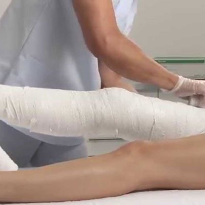 knee-fracture-treatment-chennai