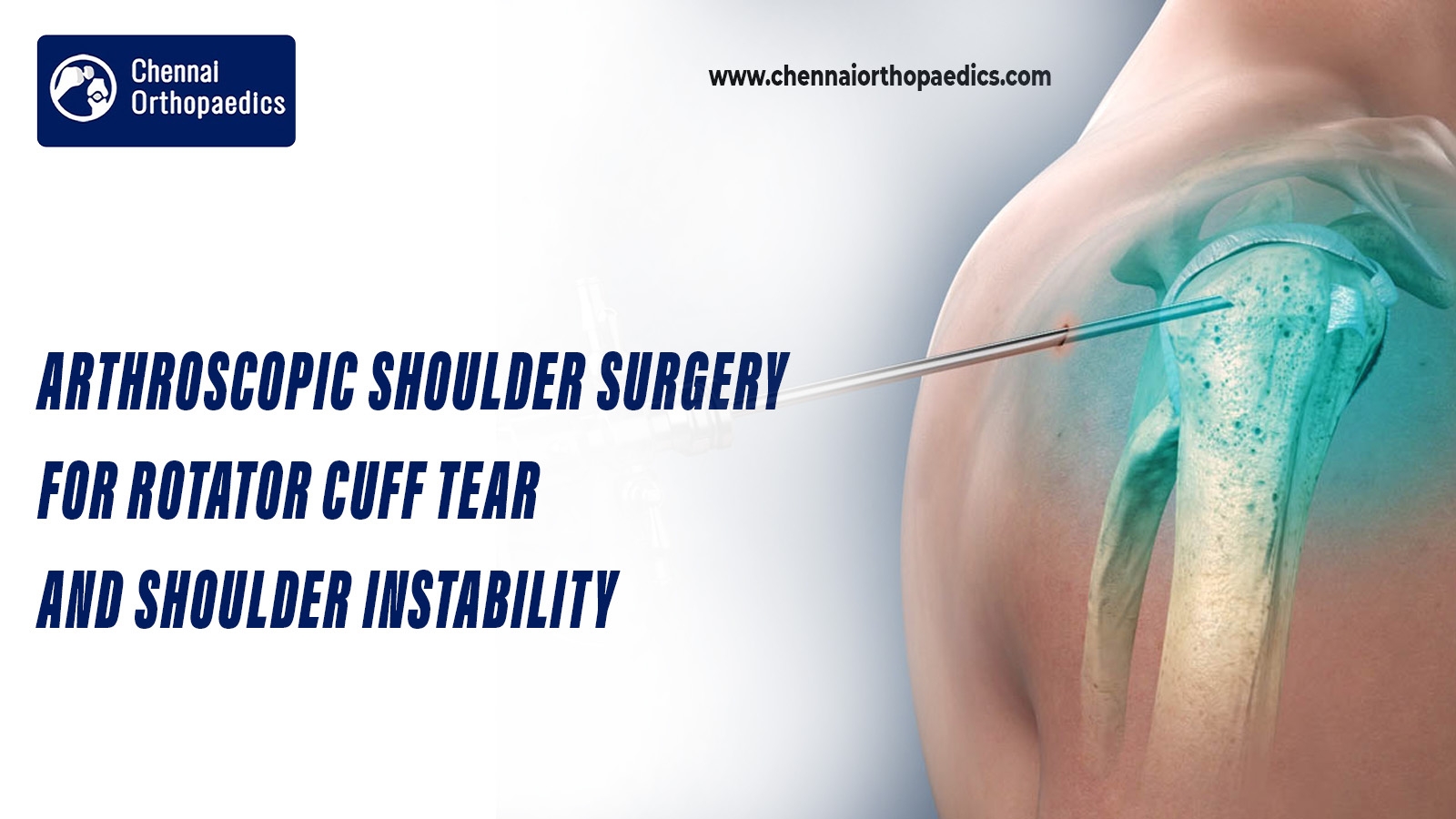 arthroscopic-shoulder-surgery-rotator-cuff-tear-instability