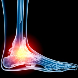 ankle joint pain