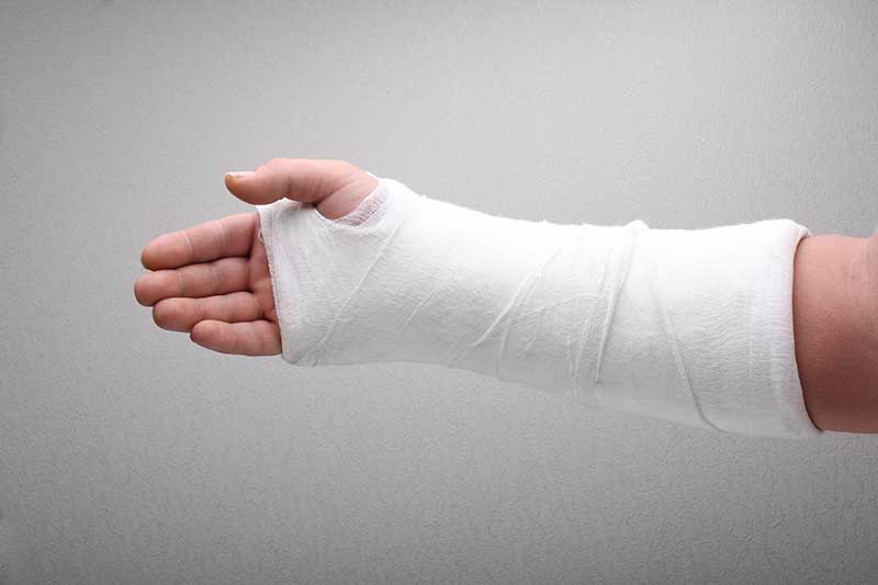 wrist fracture treatment