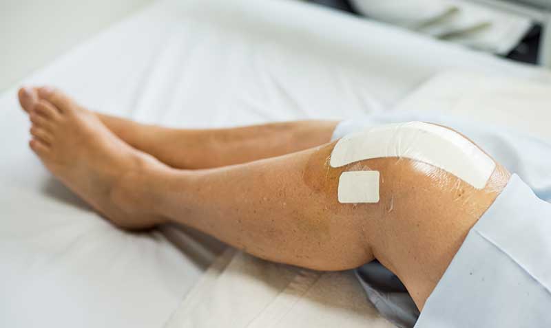 partial knee replacement in chennai