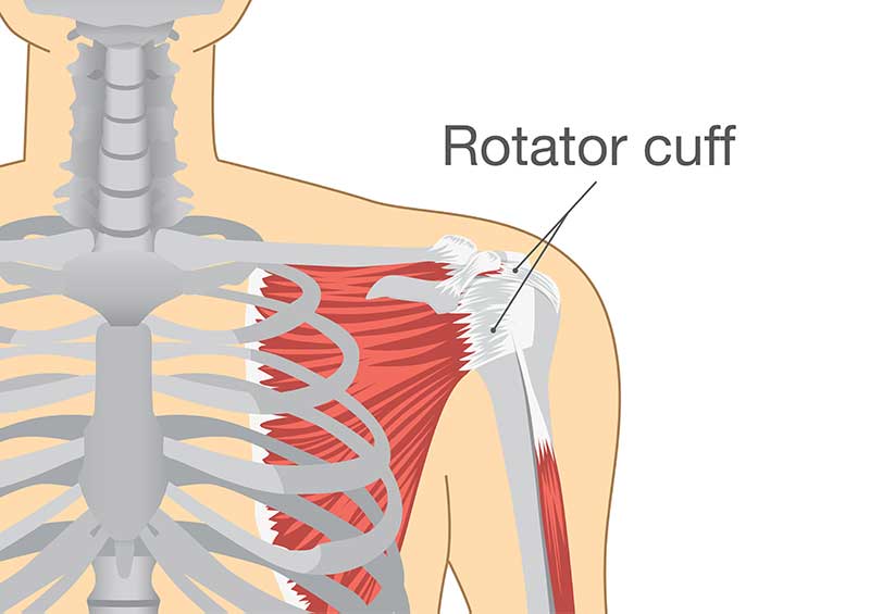 arthroscopy for rotator cuff tear in chennai